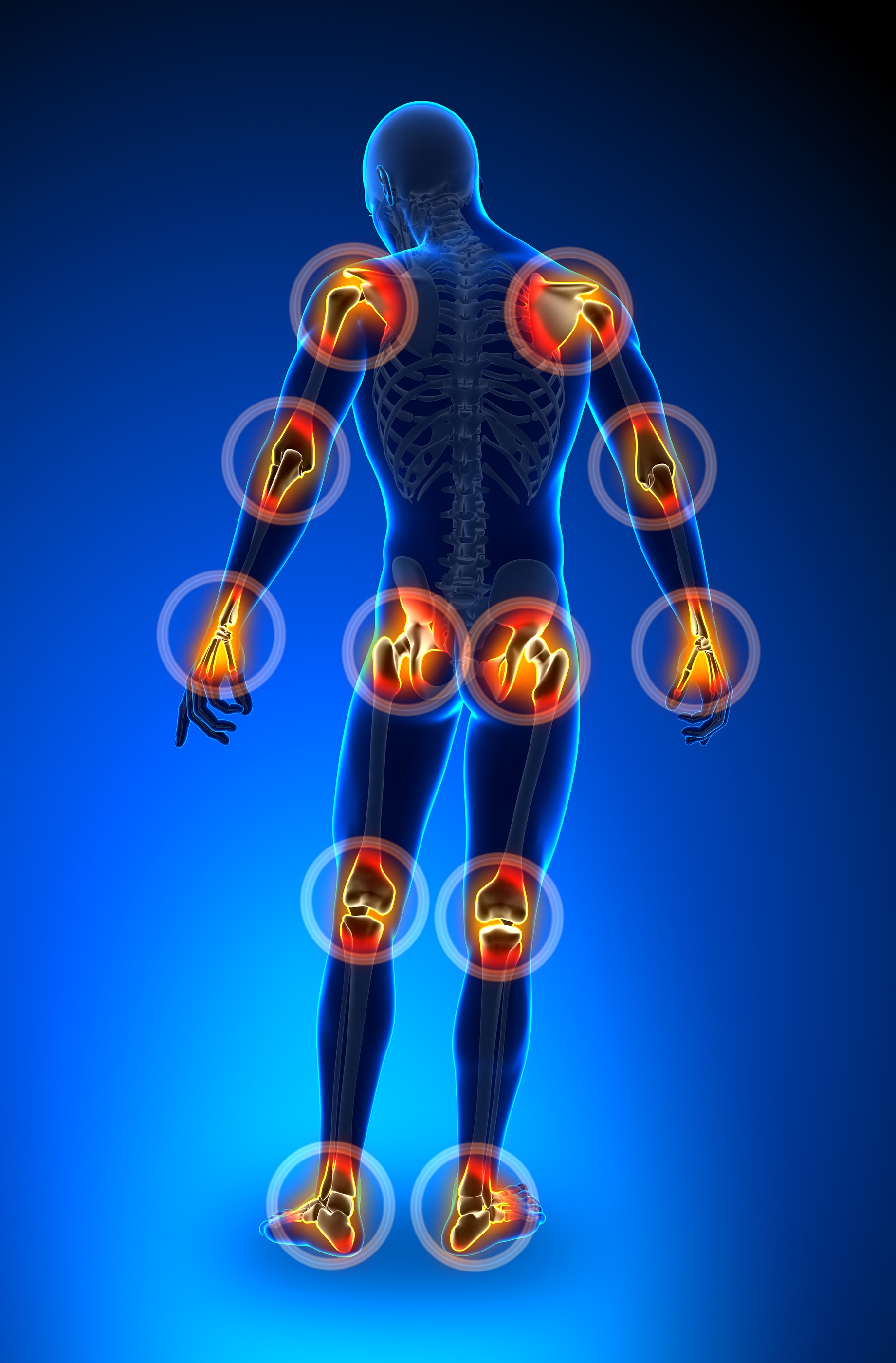 joints-bursa-and-tendon-pain